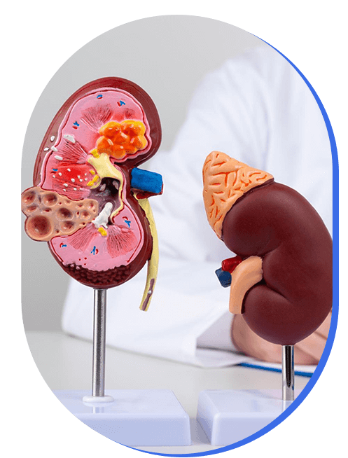 filtracion-glomerular-tarifa.png