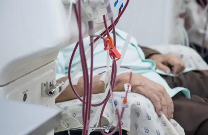 Colocación de accesos vasculares para hemodiálisis